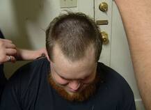 गंजापन दूर करने के लिए लोग अपनाते हैं ऐसी-ऐसी हैरतअंगेज तरकीब