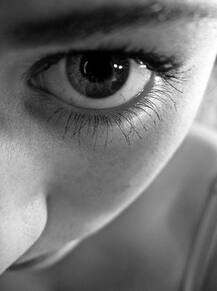 OMG! महिला के गाल पर कीड़ों ने बना लिया अपना घर, जानें फिर क्या हुआ