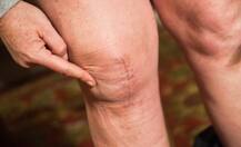 World arthritis day: भारत में हर छठा व्यक्ति गठिया की चपेट में