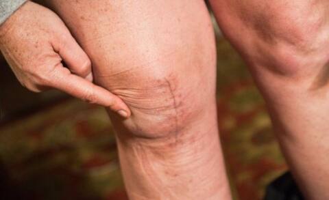 World arthritis day: भारत में हर छठा व्यक्ति गठिया की चपेट में World arthritis day: भारत में हर छठा व्यक्ति गठिया की चपेट में