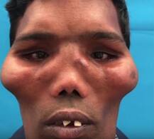 शेर की तरह दिखता था इस आदमी का चेहरा, अब दिखता है ऐसा