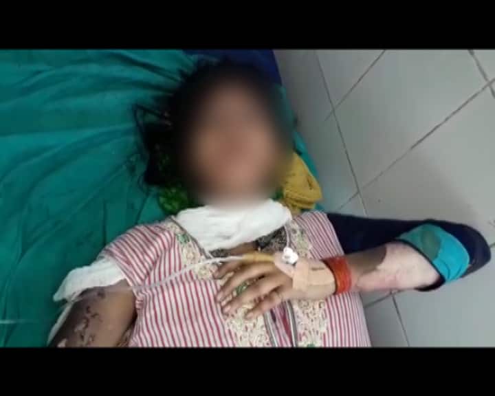बिहार: रेप से बचने के लिए तीसरी मंजिल से कूदी नौवीं की छात्रा, हाई टेंशन तार से झुलसी girl jumped from third floor to save herself from rape, bihar बिहार: रेप से बचने के लिए तीसरी मंजिल से कूदी नौवीं की छात्रा, हाई टेंशन तार से झुलसी