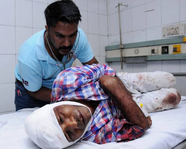 हादसे में घायलों का उपचार हॉस्पिटल में चल रहा है. कई लोगों को गंभीर चोटे आई हैं. 