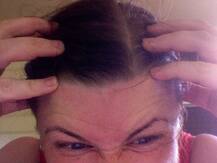 क्या अक्सर आपको भी बालों में होती है खुजली? तो ये खबर पढ़ें