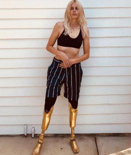 आज लॉरेन आर्टिफिशियल पैरों से अपने करियर के मुकाम पर हैं. लॉरेन अब कई एंजेसी और कंपनियों के लिए काम करती हैं. फोटोः इंस्टाग्राम