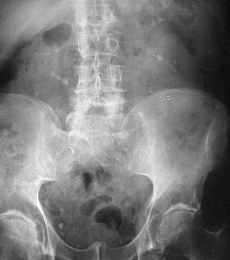 दरअसल, डॉक्टर्स ने गलती से महिला की हेल्दी किडनी को शरीर में बढ़ने वाला एक कैंसरनुमा ऑर्गन समझा जिसे ऑपरेशन के दौरान निकाल दिया गया.   जानिए क्या था पूरा मामला. फोटोः गूगल फ्री इमेज 