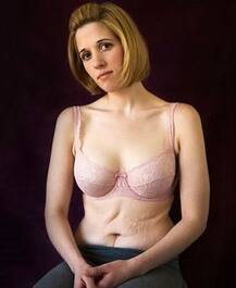 इस महिला ने मोटापे से परेशान हो किया वजन कम, अब हो गई है डिप्रेशन का शिकार