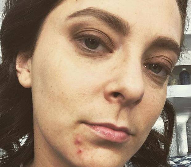 अमेरिकन एक्ट्रेस और सिंगर राहेल ब्लूम का ने इंस्टाग्राम पर अपनी ये तस्वीर पोस्ट करते हुए लिखा था कि सीज़न की शूटिंग के बीच (एपिसोड 8 के आसपास) बिजी शेड्यूल के कारण मेरे हार्मोन चरम पर है. मैं इन्हें दूर करने की पूरी काशिश कर रही हूं. फोटोः इंस्टाग्राम