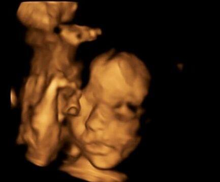 सिम्पसन का कहना है कि उसकी इस सर्जरी के दौरान आसपास दुनिया के सर्वश्रेष्ठ डॉक्टर्स थे जिन्होंने इस सर्जरी को अंजाम दिया. यूके की ये ऐसी पहली सर्जरी है जिसे सफलतापूर्वक ऑपरेट किया गया है.