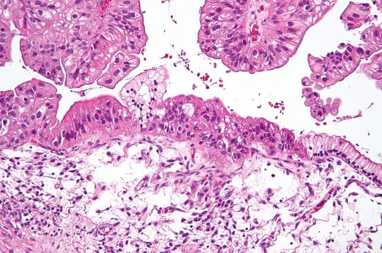 Cancer, Herbel Medicines ‘कैंसर’ को मात देना है तो ये नुस्खे हरगिज ना अपनाएं, ये जानना आपके लिए जरूरी है