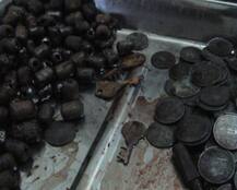 OMG! एक्स-रे में इस आदमी के पेट से दिखे पत्थर, सिक्के और बोतल के ढक्कन, जानें फिर क्या हुआ