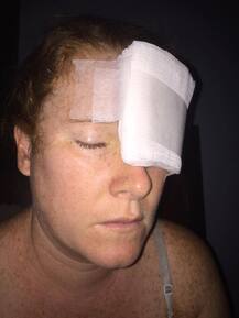 OMG! टैनिंग की वजह से एक महिला को हुआ स्किन कैंसर, जानें क्या है पूरा मामला