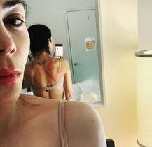 सर्दी से निजात पाने के चक्कर में इस हसीना की पीठ पर पड़ गए ऐसे निशान, जानें कैसे हुआ ये