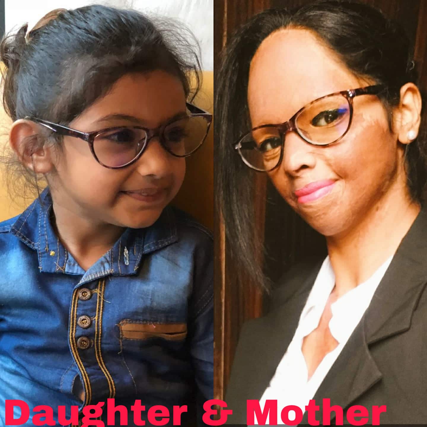 Women's Day Special: जानिए एसिड अटैक सर्वाइवर लक्ष्मी अग्रवाल की कहानी