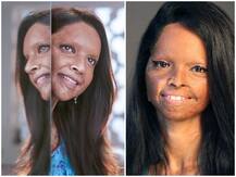 First Look: \'छपाक\' में ऐसा है दीपिका पादुकोण का लुक, सामने आई फिल्म की रिलीज डेट