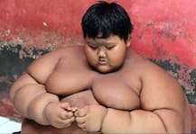 दुनिया के सबसे फैट बेबी ने किया 86 किलो वजन, अब लटक गई है इसकी स्किन, लगता है ऐसा, देखें तस्वीरें