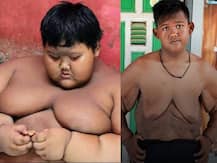 दुनिया के सबसे फैट बेबी ने किया 86 किलो वजन, अब लटक गई है इसकी स्किन, लगता है ऐसा, देखें तस्वीरें