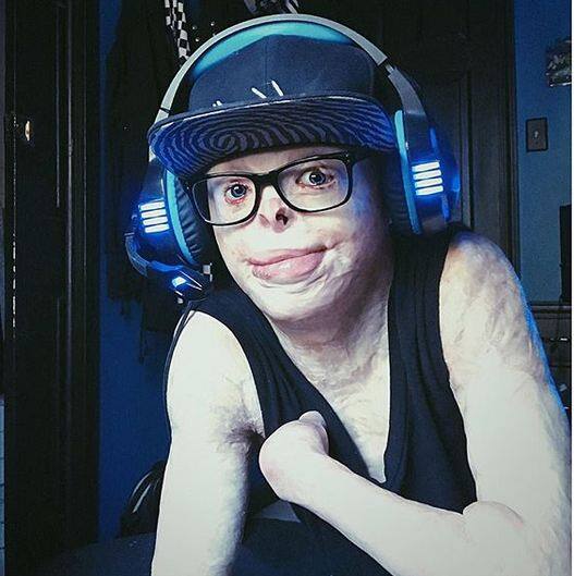 जॉनी को इंस्टाग्राम पर 66 हजार से अधिक लोग फॉलो करते हैं. 