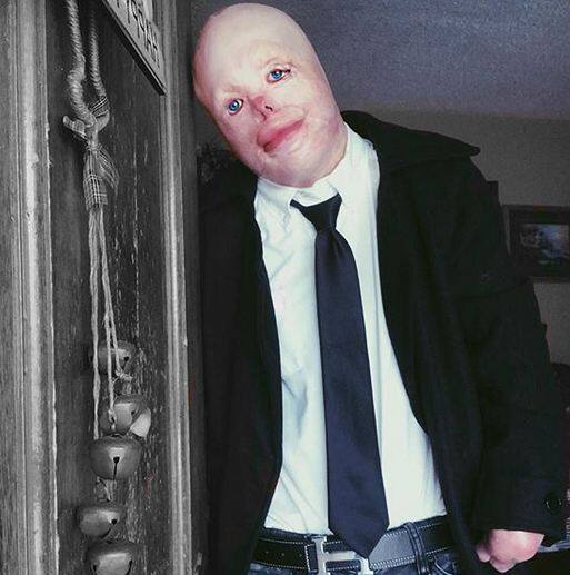 इस हादसे से जॉनी को बेशक उभरने में वक्त लगा लेकिन उसने कभी हार नहीं मानी. 