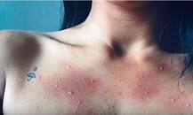 हैरतअंगेज! बच्ची को जन्म देने के बाद इस महिला को हो गई है ऐसी बीमारी, नहीं छू सकती पानी को