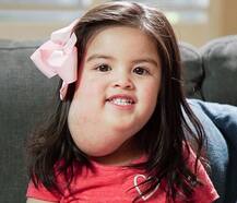 OMG! फेशियल ट्यूमर के साथ ही पैदा हुई थी ये बच्ची, जानें क्या है पूरा मामला