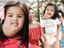 OMG! फेशियल ट्यूमर के साथ ही पैदा हुई थी ये बच्ची, जानें क्या है पूरा मामला