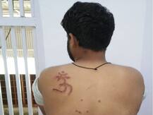 दिल्ली: तिहाड़ जेल में हैरान करने वाली वारदात, कैदी ने जेल अधीक्षक पर लगाया पीठ पर ॐ गोदने का आरोप