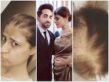 ताहिरा कश्यप ने तस्वीरों के जरिए शेयर किया कैंसर से जंग का अनुभव- किसी भी हाल में नहीं छुपाऊंगी चेहरा