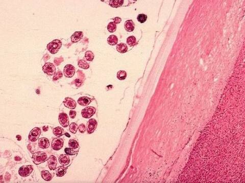 जानें, आखिर क्या है निपाह वायरस और कैसे इससे बचाव कर सकते हैं