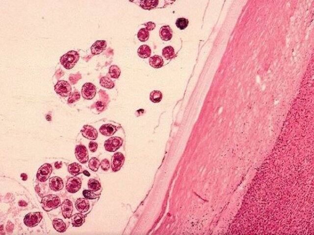 यह रोग 2001 में और फिर 2007 में पश्चिम बंगाल के सिलीगुड़ी में भी सामने आया था. निपाह वायरस की पहचान पहली बार 1998 में मलेशिया के कैम्पंग सुंगई निपाह में एक बीमारी फैलने के दौरान हुई थी.