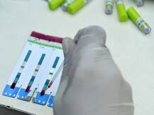 गोवा सरकार जल्द बनाने जा रही है अनोखा कानून, शादी से पहले होगा HIV टेस्ट