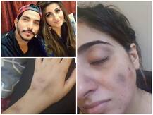 मोहसिन अब्बास हैदर पर गर्भवती पत्नी को पीटने का आरोप, पत्नी बोलीं- बाल खींचे, फर्श पर घसीटा और लात मुक्के मारे