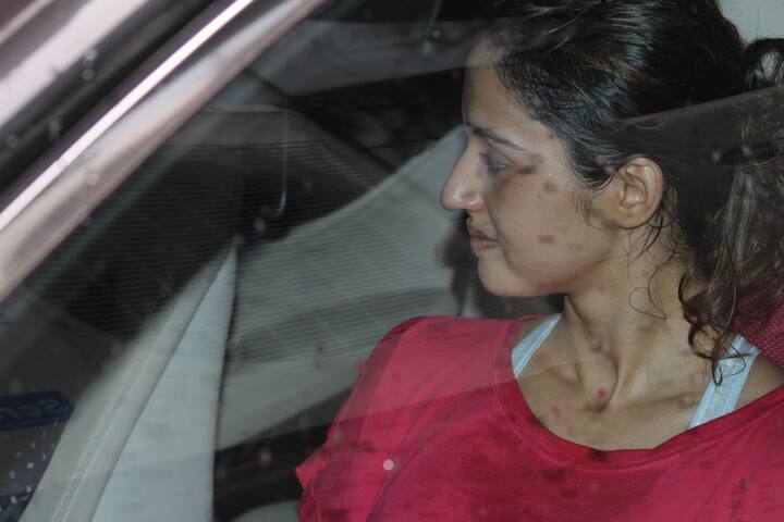 ये तस्वीरें देखकर आप भी अंदाजा लगा सकते हैं कि उनकी तबीयत कितनी खराब है लेकिन इसके बावजूद वो काम से ब्रेक नहीं ले रही हैं.