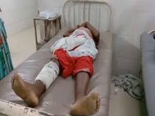 बिहार में अजीबोगरीब मामला, हाइड्रोसील की जगह डॉक्टरों ने कर दिया पैर का ऑपरेशन