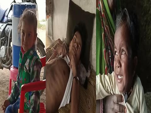 बाल दिवस: बच्चों की जान से खिलवाड़, अफसरों की लापरवाही ने लगवाए अस्पतालों के चक्कर बाल दिवस: बच्चों की जान से खिलवाड़, अफसरों की लापरवाही ने लगवाए अस्पतालों के चक्कर