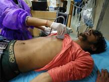 'अंधा है तो प्रदर्शन में क्यों आया' बोलकर पुलिस ने पेट में मारे घूंसे- JNU छात्र की आपबीती