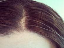 सफेद बालों से निजात पाने के लिए अपनाएं ये घरेलू नुस्खे