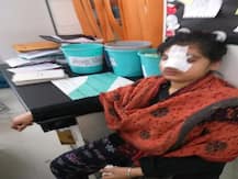 गुरुग्राम: दबंगों ने घर में घुसकर युवती की नाक काटी, परिवार के साथ भी की मारपीट