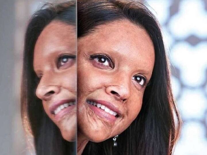 Meghna Gulzar's film Chhapak gets U certificate, will be released on January 10 मेघना गुलजार की फिल्म “छपाक” को मिला “यू” सर्टिफिकेट, 10 जनवरी को होगी रिलीज