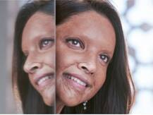 Tik Tok पर 'छपाक' लुक का चैलेंज देना दीपिका को पड़ा भारी, जमकर हुईं ट्रोल