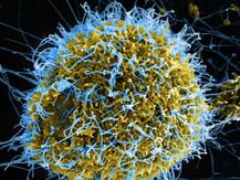 कोरोना वायरस : केरल ने जारी किया अलर्ट, हवाई अड्डे पर बढ़ायी गई निगरानी