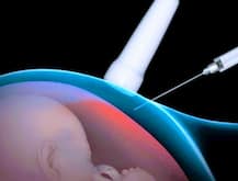 जम्मू पुलिस ने किया गर्भपात सेंटर का भंडाफोड़, एक महिला डॉक्टर गिरफ्तार