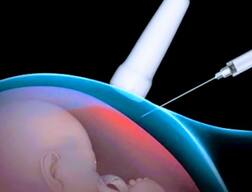 जम्मू पुलिस ने किया गर्भपात सेंटर का भंडाफोड़, एक महिला डॉक्टर गिरफ्तार