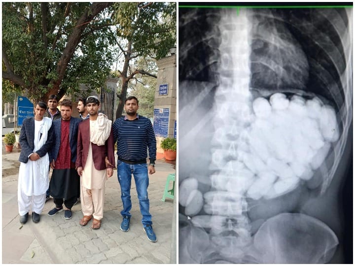 Three Afghani arrested with drugs at Delhi airport पेट में ड्रग्स की गोलियां छुपाकर ला रहे थे तीन अफगानी, दिल्ली एयरपोर्ट पर पकड़े गए