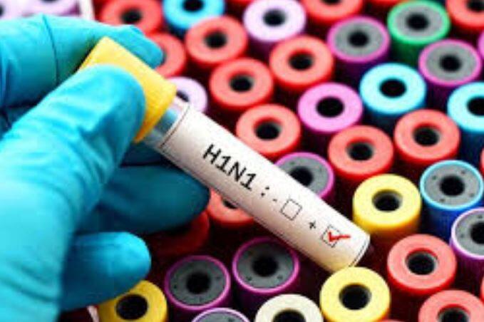 This disease is caused by H1N1 virus how to prevent it बेंगलुरू में फैल रहा है H1N1, जानिए- इस बीमारी के लक्ष्ण क्या हैं और कैसे करें बचाव