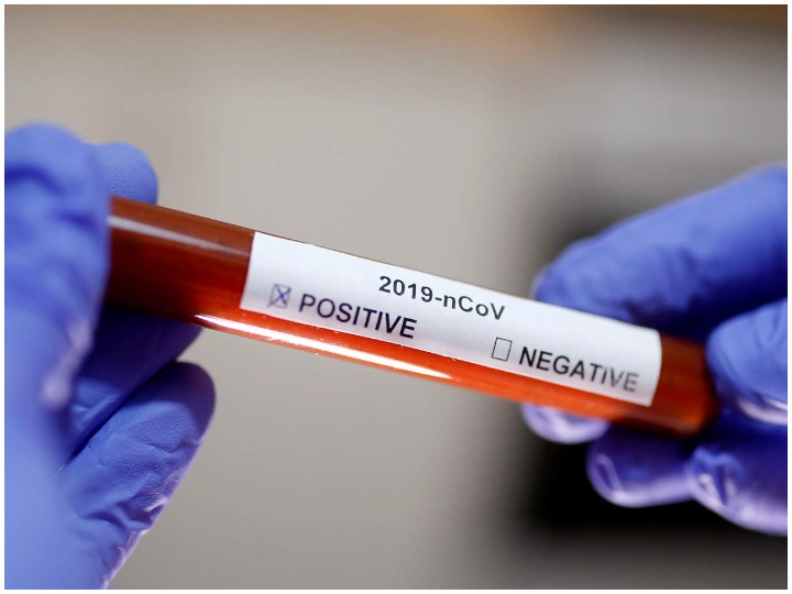 coronavirus drug identified by Australian scientists