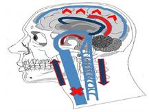 दिमाग में होने वाली सोच को पढ़कर शब्द टाइप करने वाली तकनीक पर जारी है शोध
