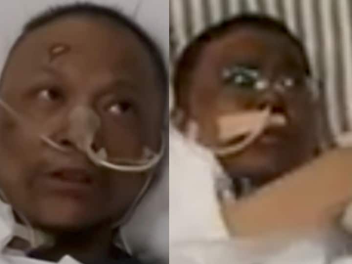 china wuhan doctor skin colour changed due to coronavirus COVID-19: चीन में मरीजों का इलाज कर रहे वुहान के दो डॉक्टर कोरोना से संक्रमित हुए, काला पड़ गया चेहरे का रंग