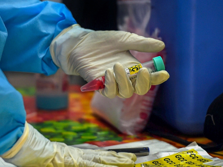 Coronavirus: भारत के इन 5 शहरों में हैं कोविड-19 के 51.8 फीसदी केस 51.8 percent cases of coronavirus in these 5 cities of India ANN