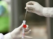 कोरोना वायरस: वैज्ञानिकों की मेहनत रंग लाएगी, दवा आएगी | दुनियाभर में चल रही कोशिशों की एक झलक